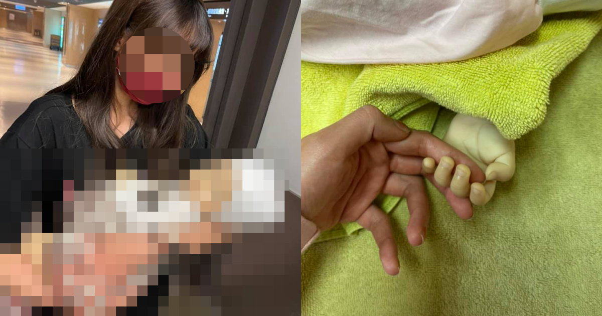 一名女嬰疑似遭到保母虐待，頭部重創、雙眼出血，送醫急救後不治身亡。（翻攝自臉書）