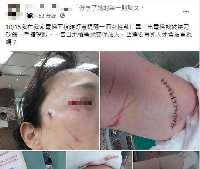 北市一名女子出言規勸鄰居戴口罩,不料竟被砍傷。(翻攝爆料公社)