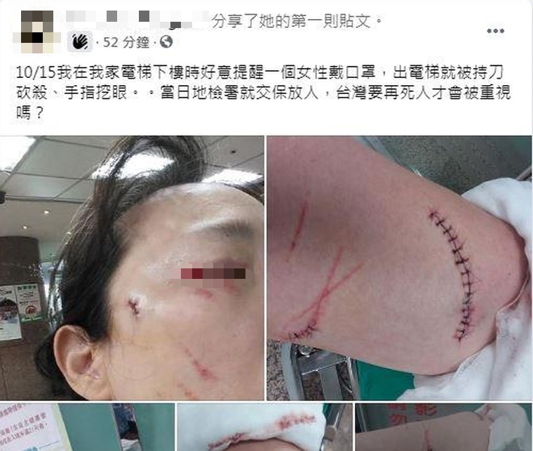北市一名女子出言規勸鄰居戴口罩，不料竟被砍傷。（翻攝爆料公社）
