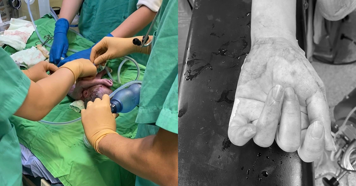 一名麻醉科醫師分享搶救嚴重出血的產婦及新生兒的經歷,不少網友為之動容。(翻攝自麻醉醫師靈魂所在的地方臉書)