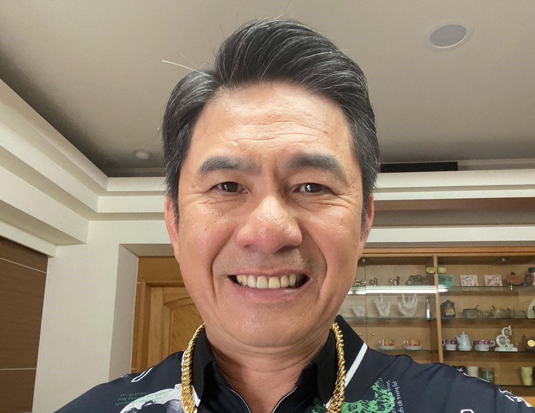 洪都拉斯多年前多次膽囊炎復發，後已切除膽。（翻攝洪都拉斯IG）