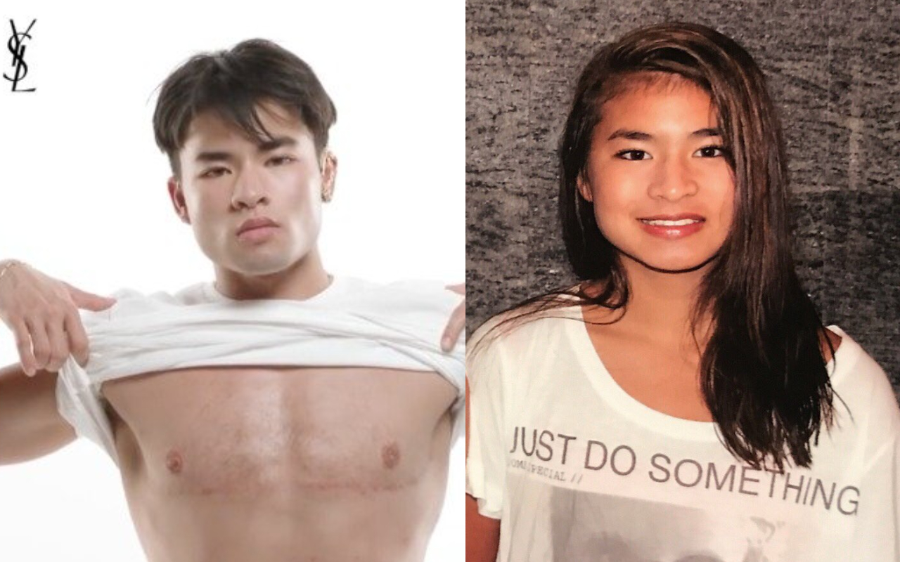 Chella Man在YSL美妝廣告大方展示變性手術留下的疤痕。（翻攝自Chella Man IG） 