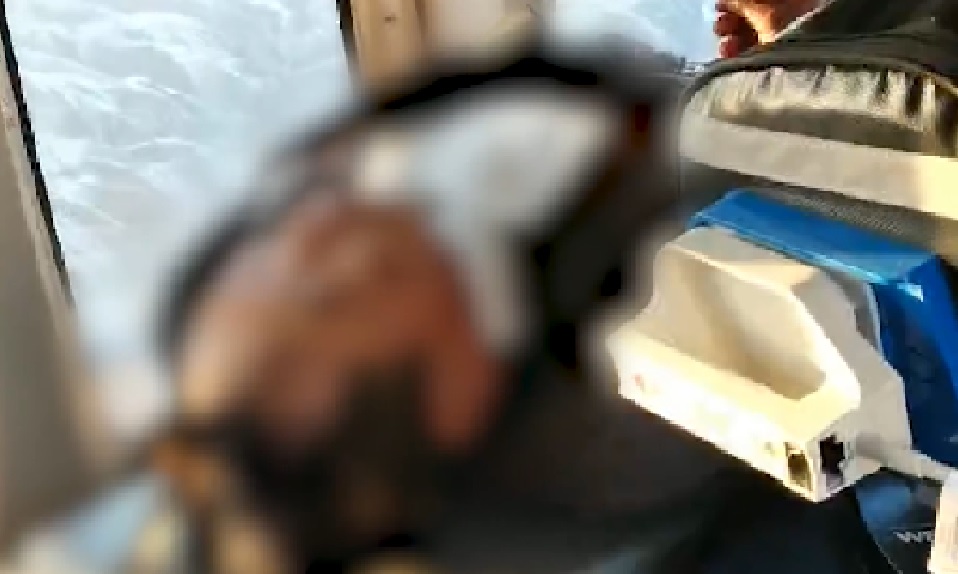 村民不慎在雪地跌倒，竟被木棍刺穿喉嚨，喉嚨直接裸露在外。（翻攝《白鹿視頻》）