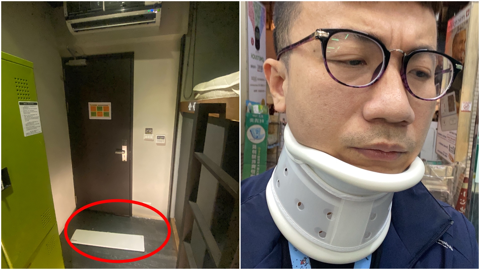 台語歌手黃大衛指控連鎖商旅的冷氣蓋板突然掉落，砸傷他的後腦和後頸。（讀者提供）