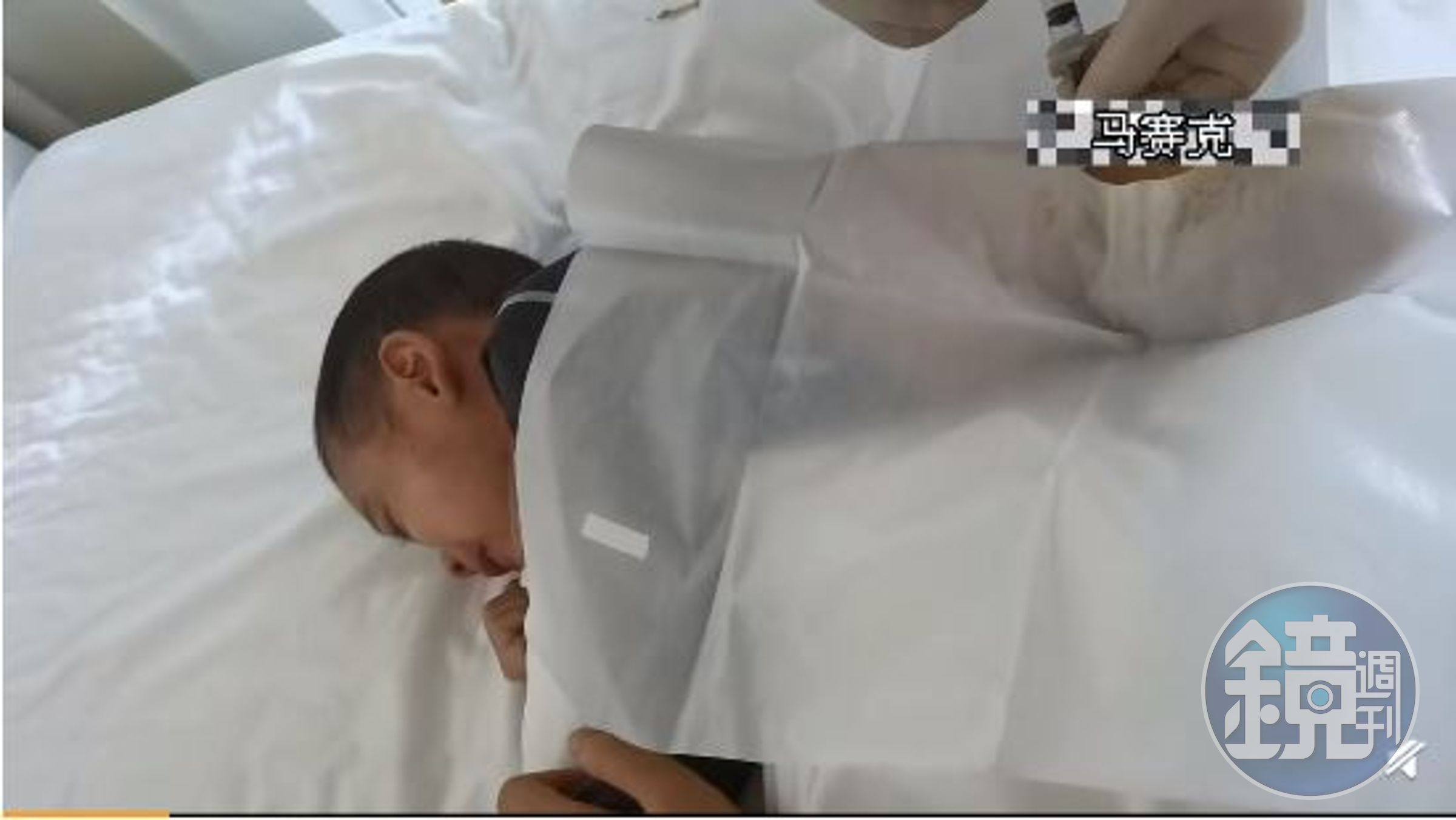 小默默忍著疼痛接受脊椎穿刺，痛極了才會小小聲說「阿姨輕點，太疼了」。（翻攝自抗白小默默微博）