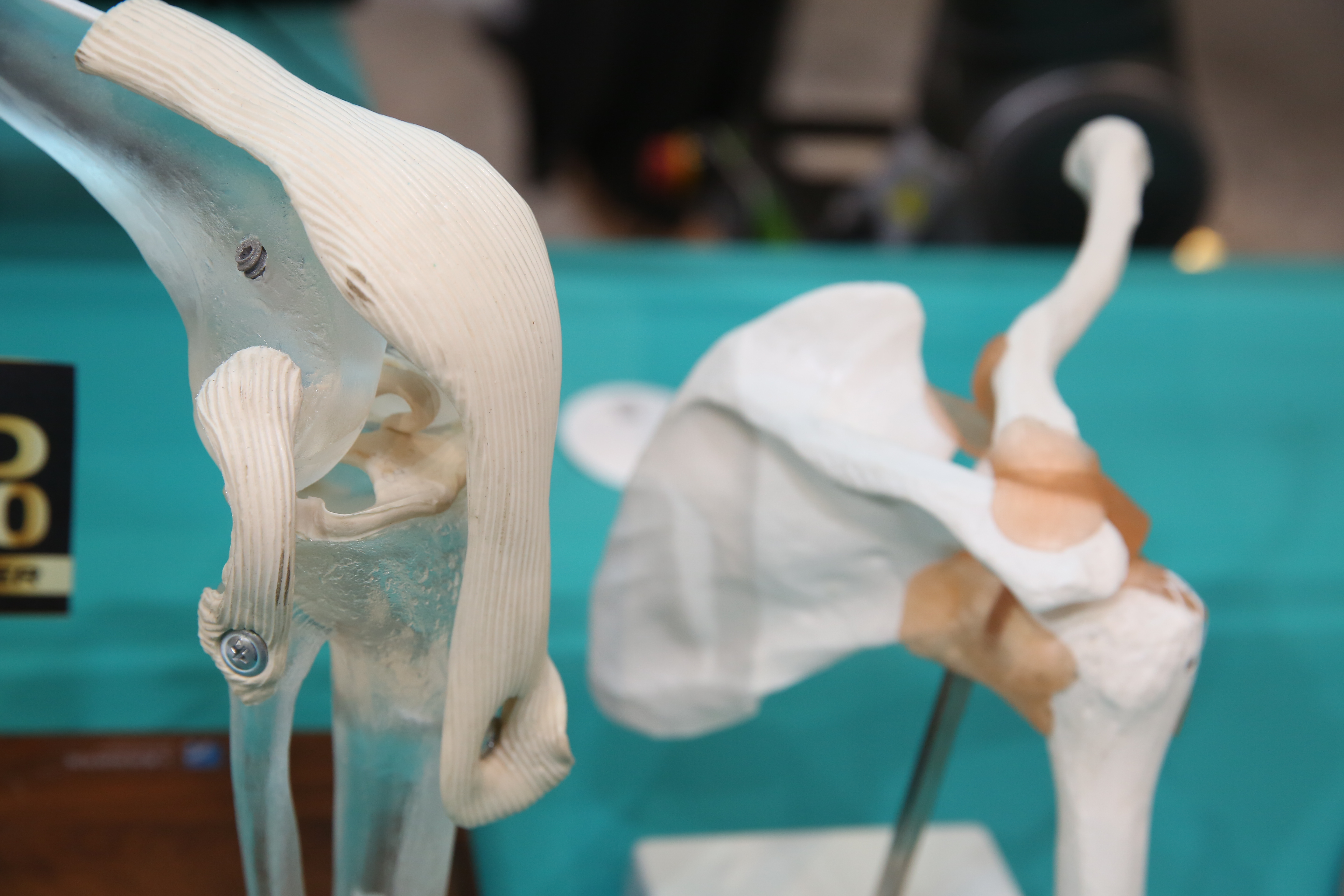 民眾手術若追求更好醫療品質、採用自費醫材，費用相當可觀。