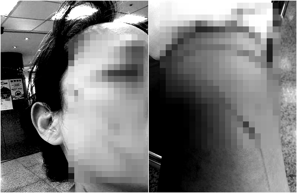 王女好心遭鄰居陳婦戴口罩，卻慘遭對方徒手挖眼、持刀揮砍。（翻攝爆料公社）