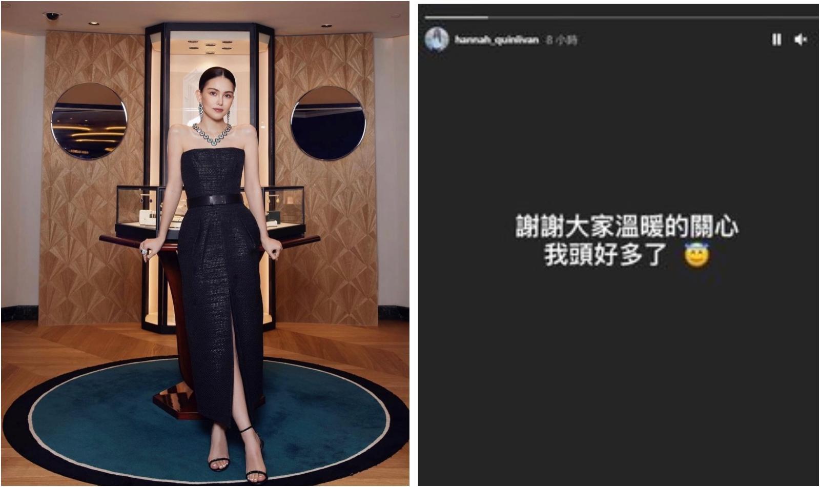 昆凌在家中意外撞到頭部，取消活動出席。（翻攝自昆凌IG）
