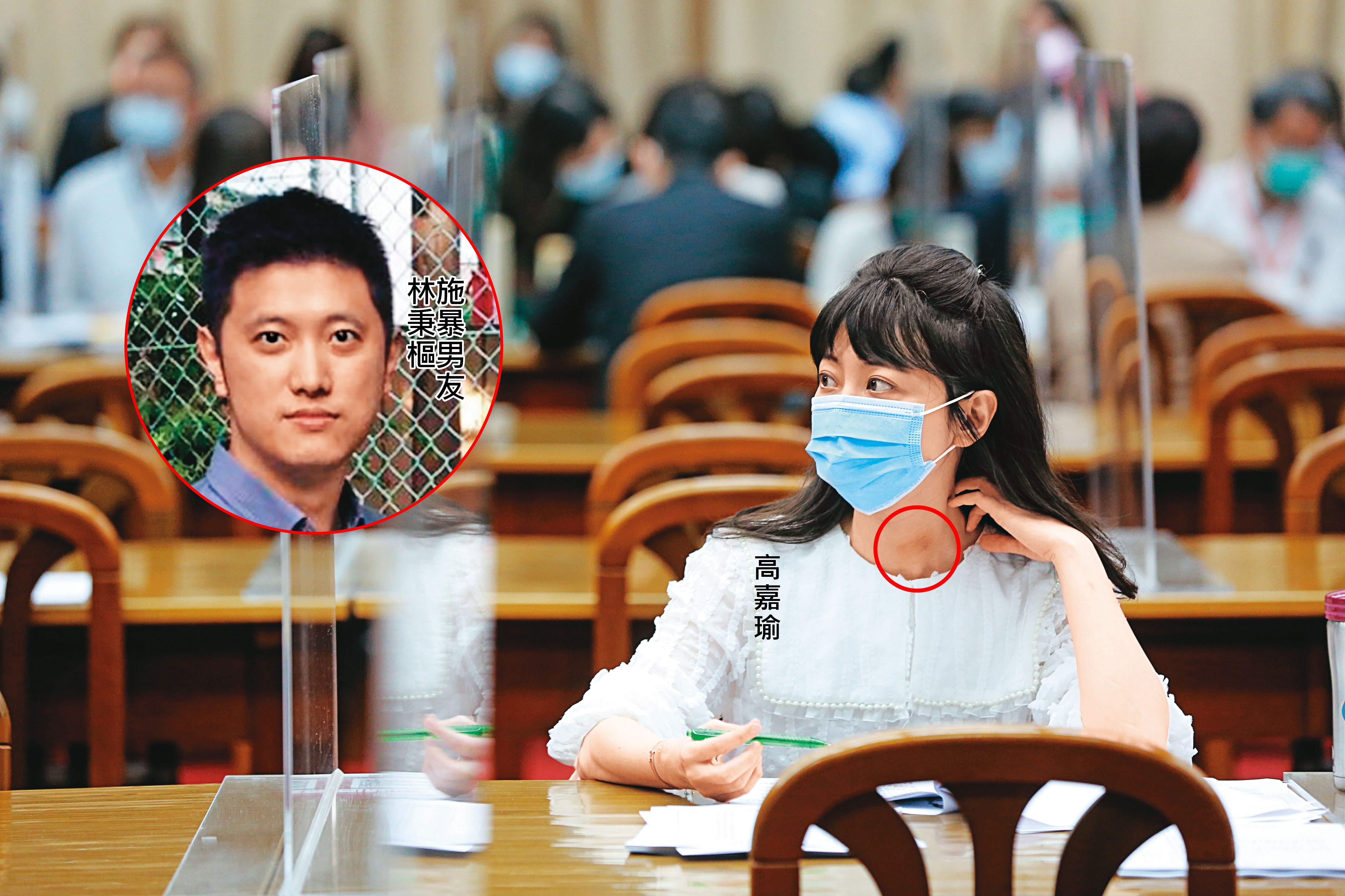 高嘉瑜29日現身立法院財委會等候質詢時，脖子上的瘀傷（紅圈處）還清晰可見。