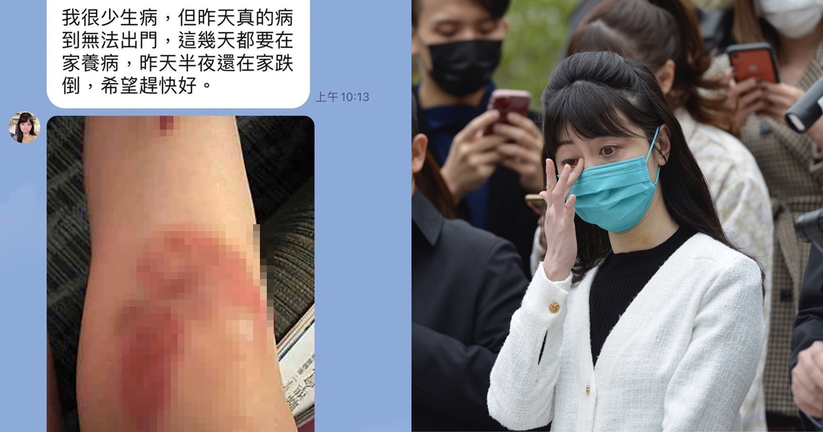 導演汪怡昕公開妻子與高嘉瑜（右）的對話，高自稱生重病、跌倒受傷，對於家暴隻字未提。（翻攝自Issac Wang臉書、本刊資料照）