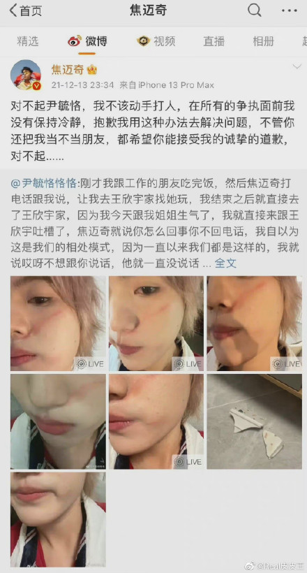 焦邁宇向尹毓恪道歉後，尹毓恪仍繼續批評。（網路圖片）