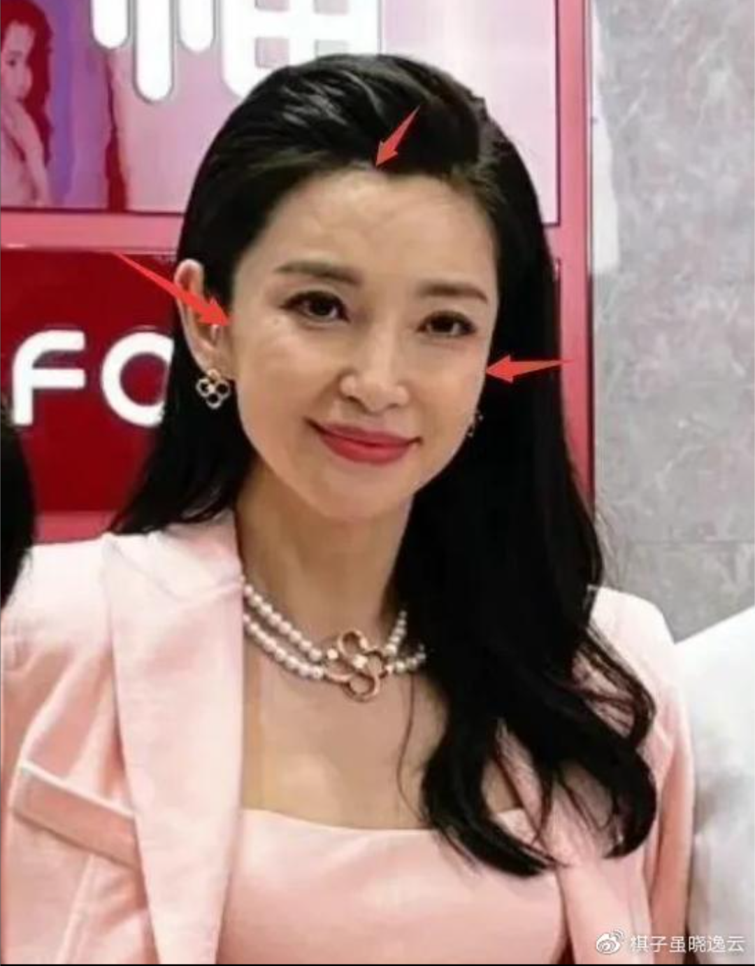 未修生圖裡李冰冰的臉卻是凹凸不平，笑容也僵硬，被懷疑打了醫美產品。（微博圖片）