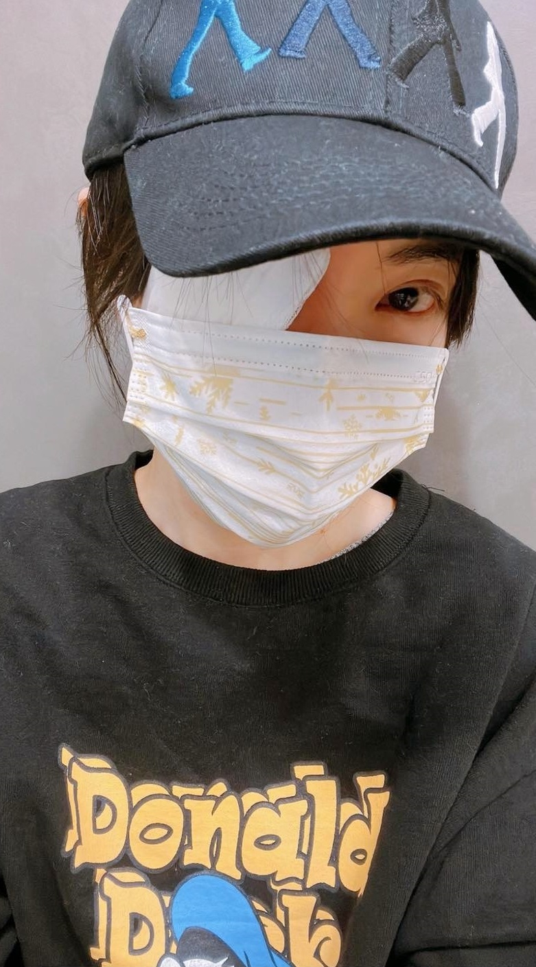 去年12月30日謝金燕曬出慘照，原來是右眼針眼發作。（翻攝謝金燕臉書）