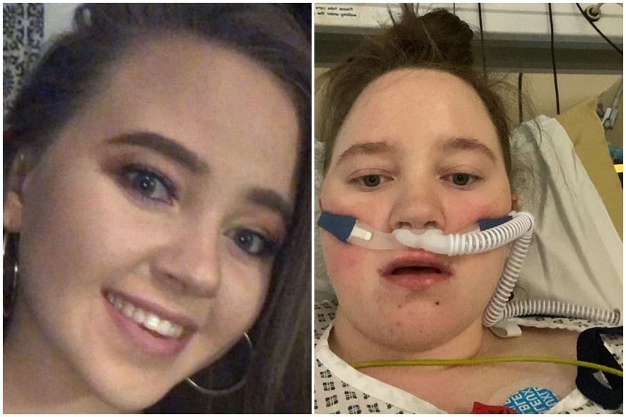 菲恩因為染疫被送往加護病房治療。（翻攝自推特）