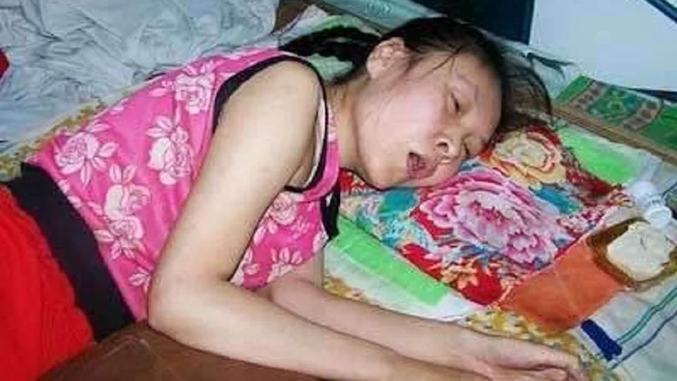 吳桂英16歲那年遭哥哥掌摑後就「癱瘓」在床20年。（翻攝自網易新聞）