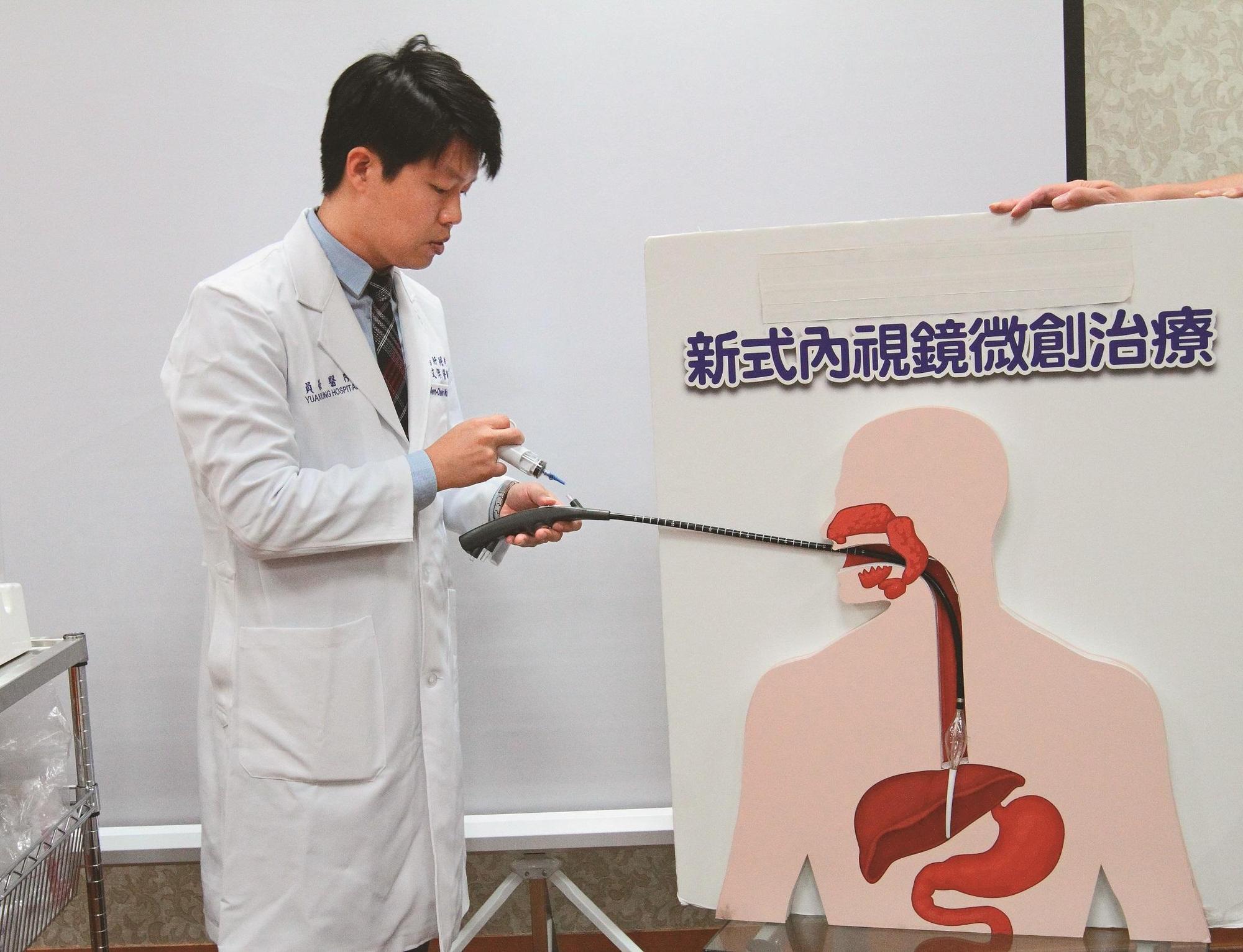 胃鏡微創熱射頻賁門緊縮術及抗逆流黏膜切除術，突破胃食道逆流患者長期服藥無效的困境。（員榮醫療體系提供）