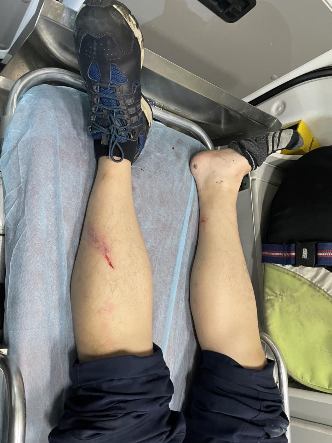 被拖行百公尺的葉姓員警受傷送醫。(警方提供)