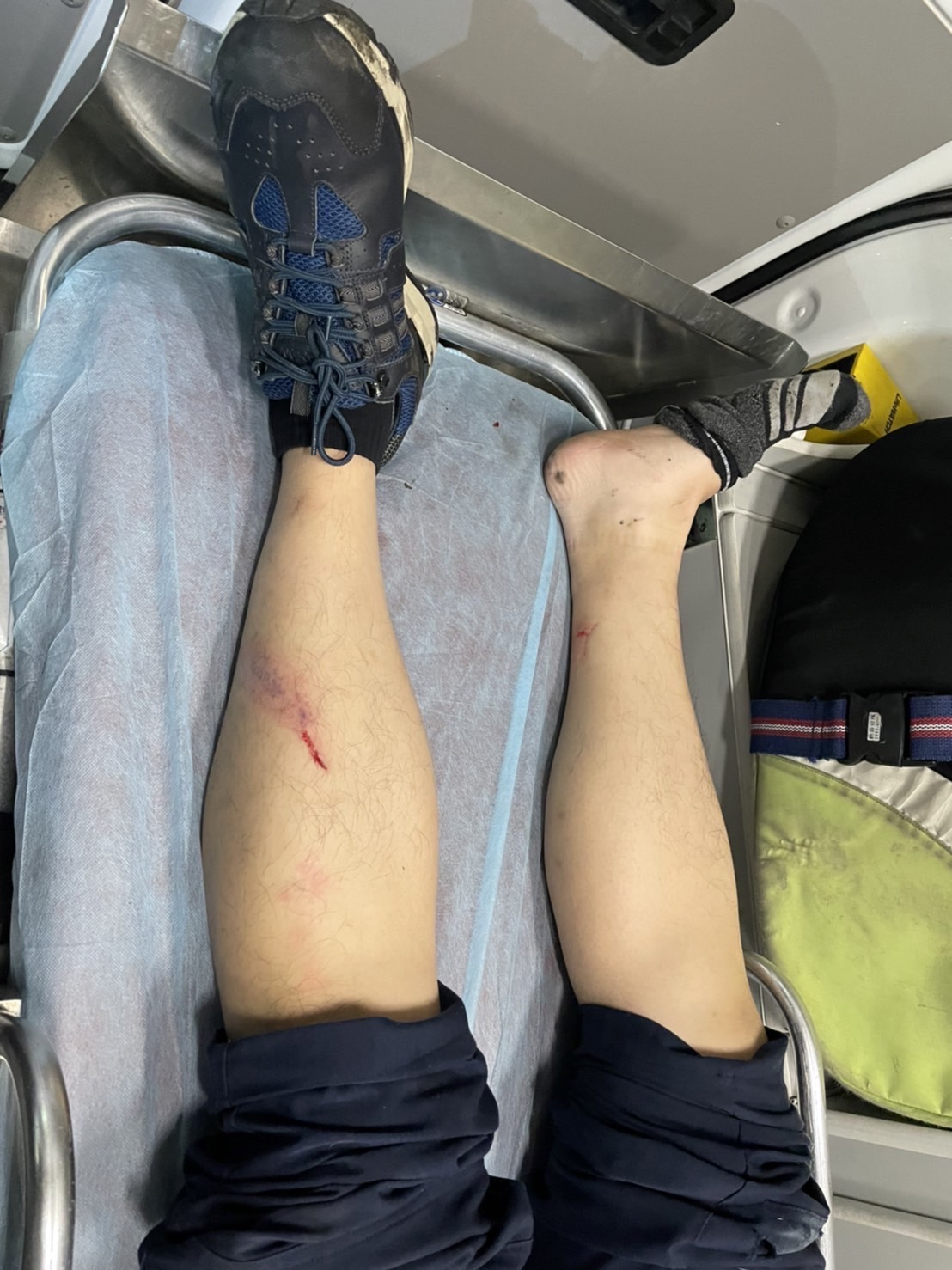 被拖行百公尺的葉姓員警受傷送醫。(警方提供)
