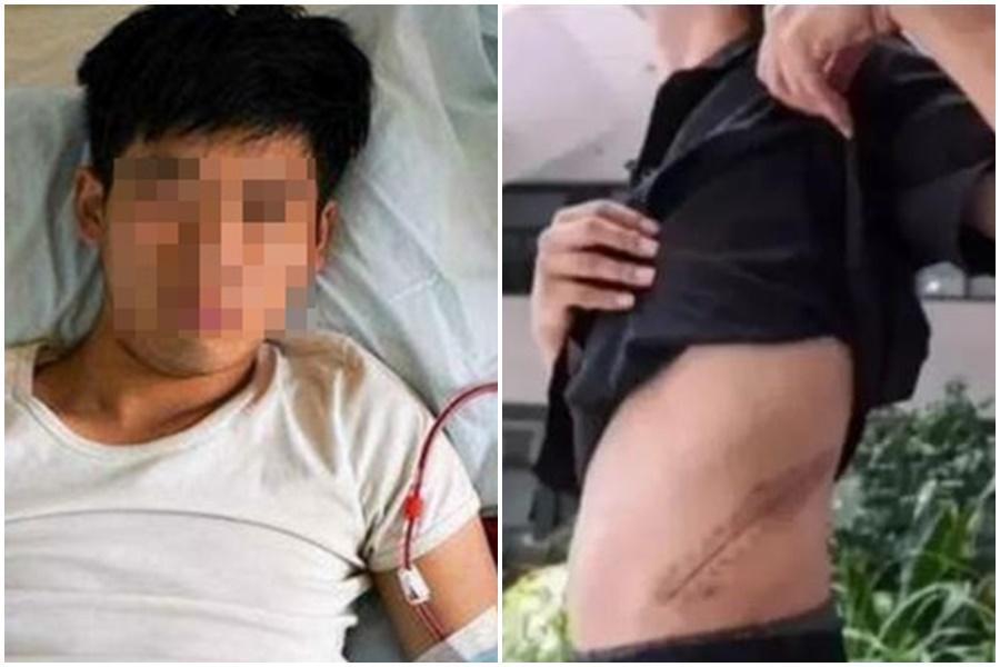 王男10年前為了買iPhone 4到黑市賣掉一顆腎臟,如今健康惡化只能臥躺在床。(翻攝自微博)