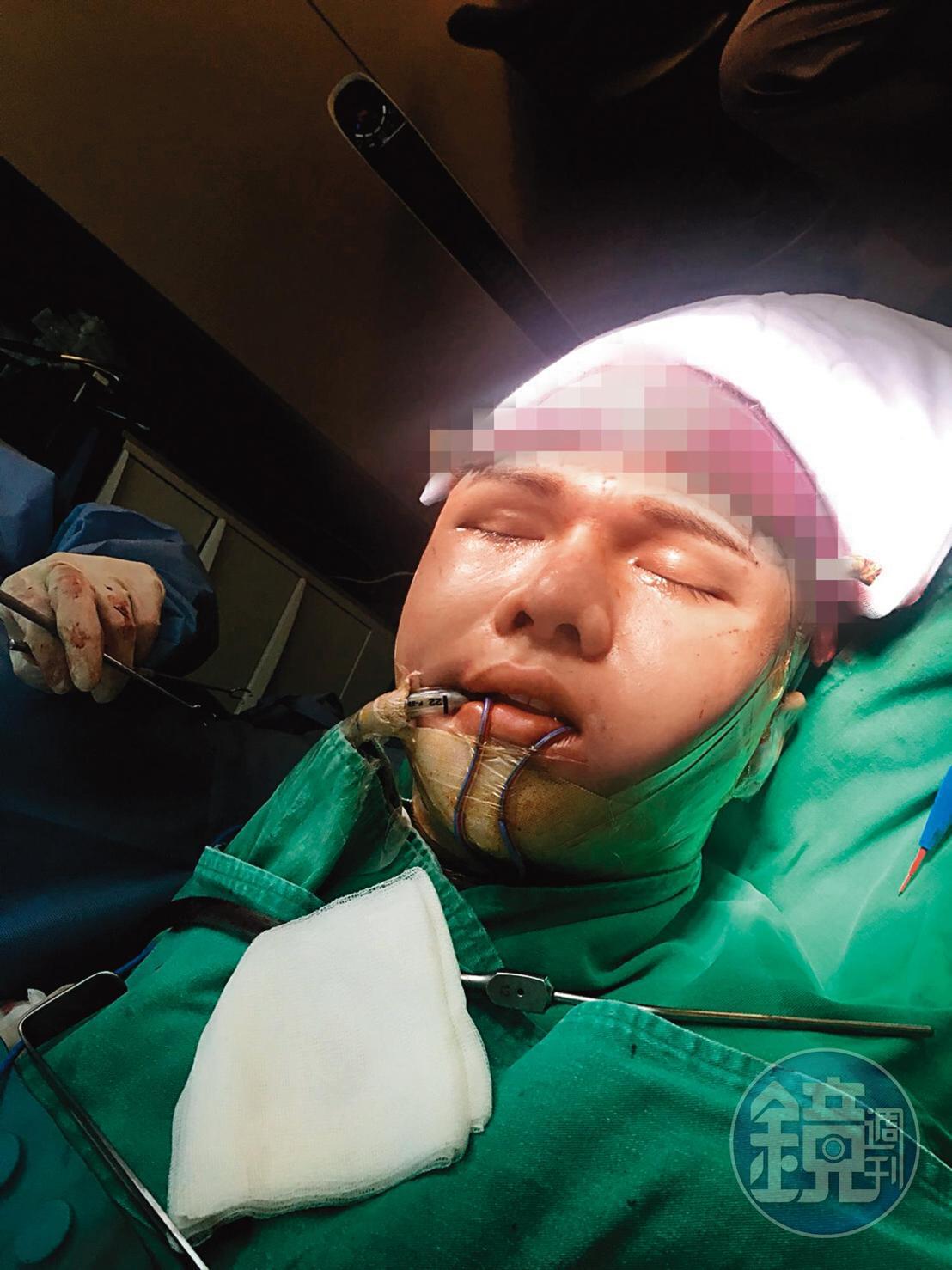 小A辣多半時間都在追求自己的美,而且不惜痛,也不怕分享給大家知道。(小A辣提供)