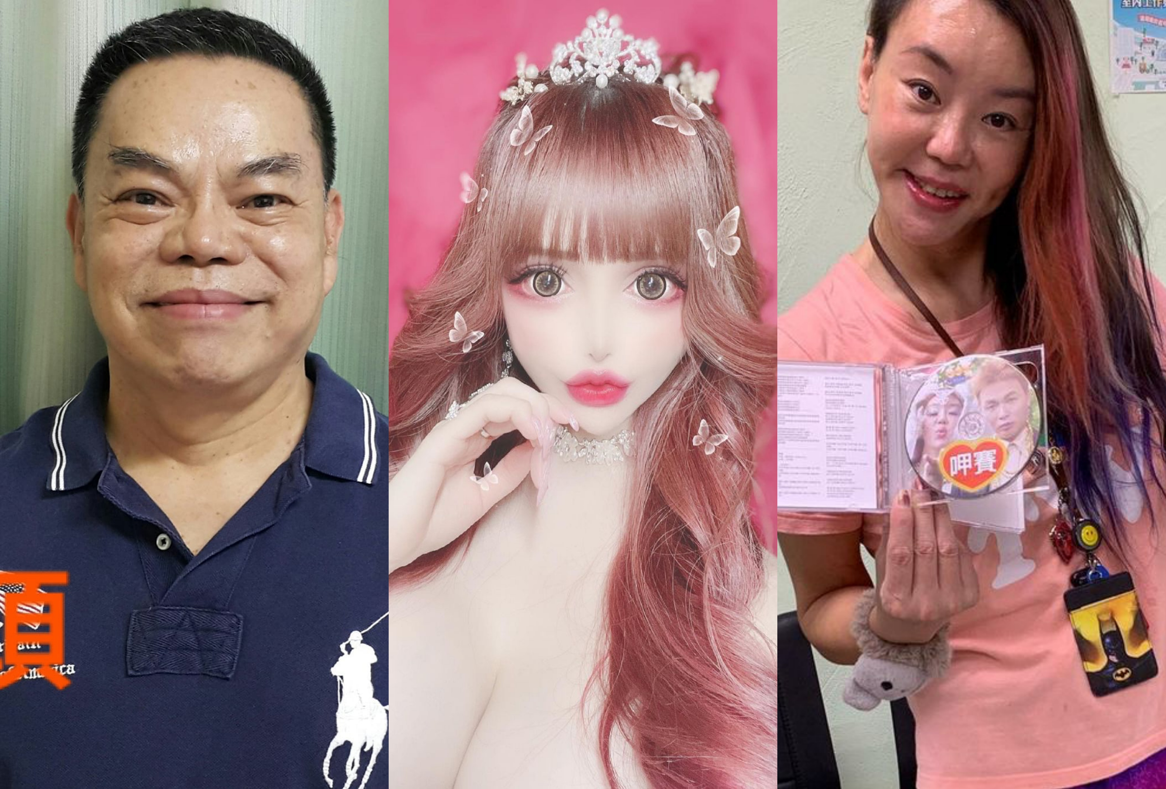 藝人也隨著時代改變，不再忌諱整形話題。（翻攝畫面）