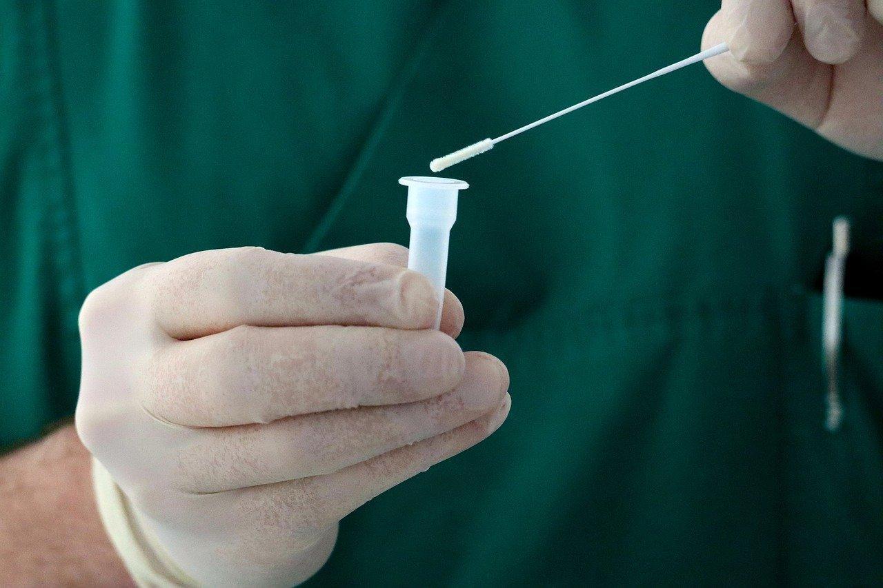 一名土耳其男子在2020年11月確診，患病過程中一共被檢測出78次陽性反應，隔離時間竟長達14個月。（示意圖，Pixabay）