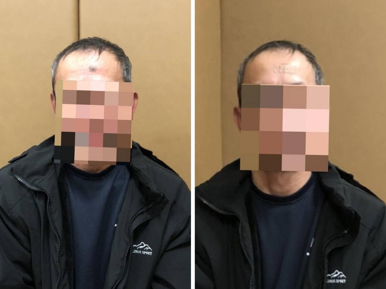 林男為躲避查緝，用美容膠帶遮掩額頭明顯胎記。（翻攝畫面）