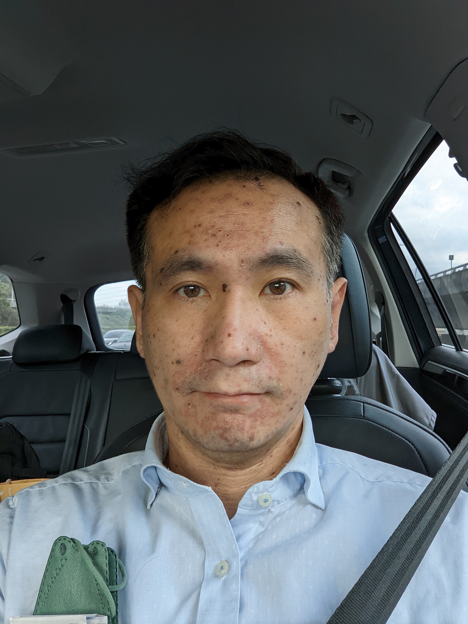 立委鄭運鵬在臉書po出近況照,只見滿臉都是水痘的疤痕。(翻攝自鄭運鵬臉書)