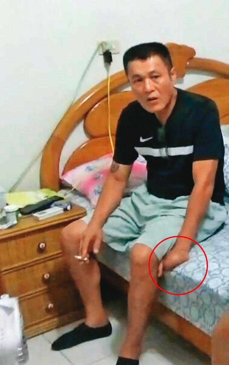 陳宏宗早年因工受傷,左手4指被截斷,只剩1根拇指(紅圈處)。(翻攝畫面)