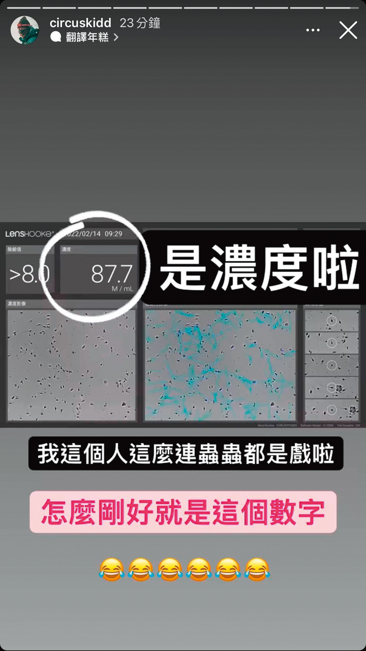 KID在社群分享2月14日情人節檢測精蟲濃度為87.7。(翻攝自KID IG)