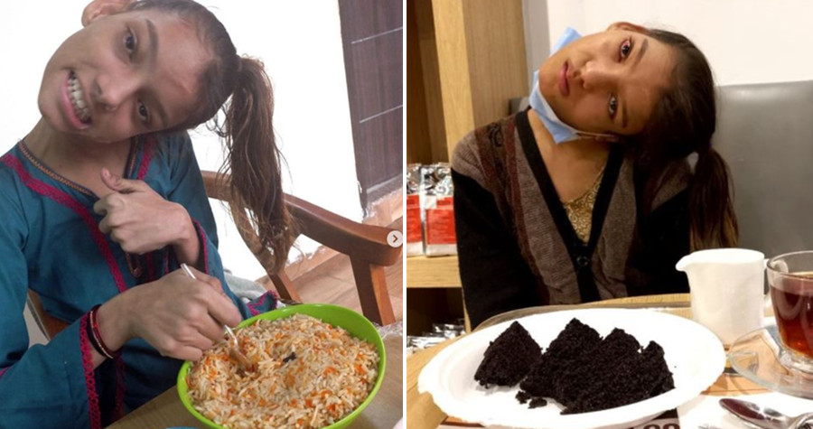 吉爾摔傷後，脖子變成90度扭曲。（翻攝afsheengul786 IG）