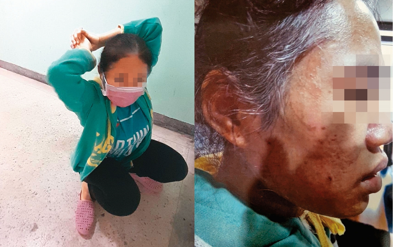 30歲的印尼女移工阿迪（圖）還原遭雇主林昶丞上銬、拖行的情況；阿迪逃出警官住處時，髮鬢灰白，樣貌憔悴。（讀者提供）