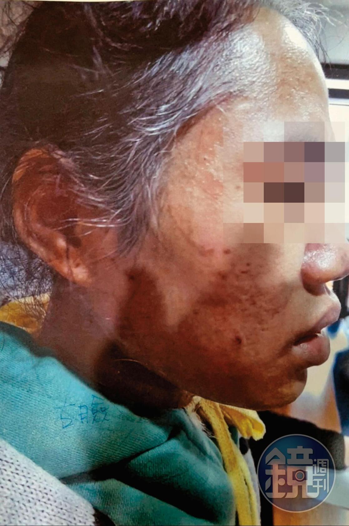 30歲的阿迪逃出警官住處時,髮鬢灰白,樣貌憔悴。(讀者提供)