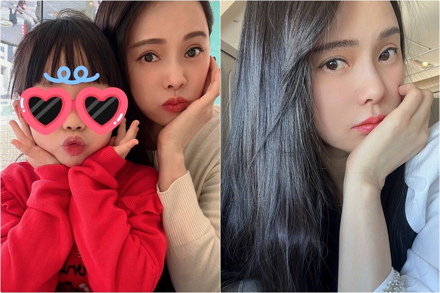 伊能靜透露白點是小時侯不小心摔下留下的,也是跟父親唯一的連結。(翻攝伊能靜小紅書)