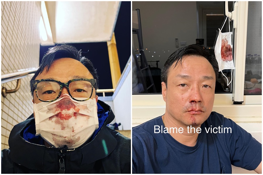 資深港星王喜昨晚因落地採檢流鼻血，不斷發文鬧上新聞版面。（翻攝自WONG HE 王喜臉書）