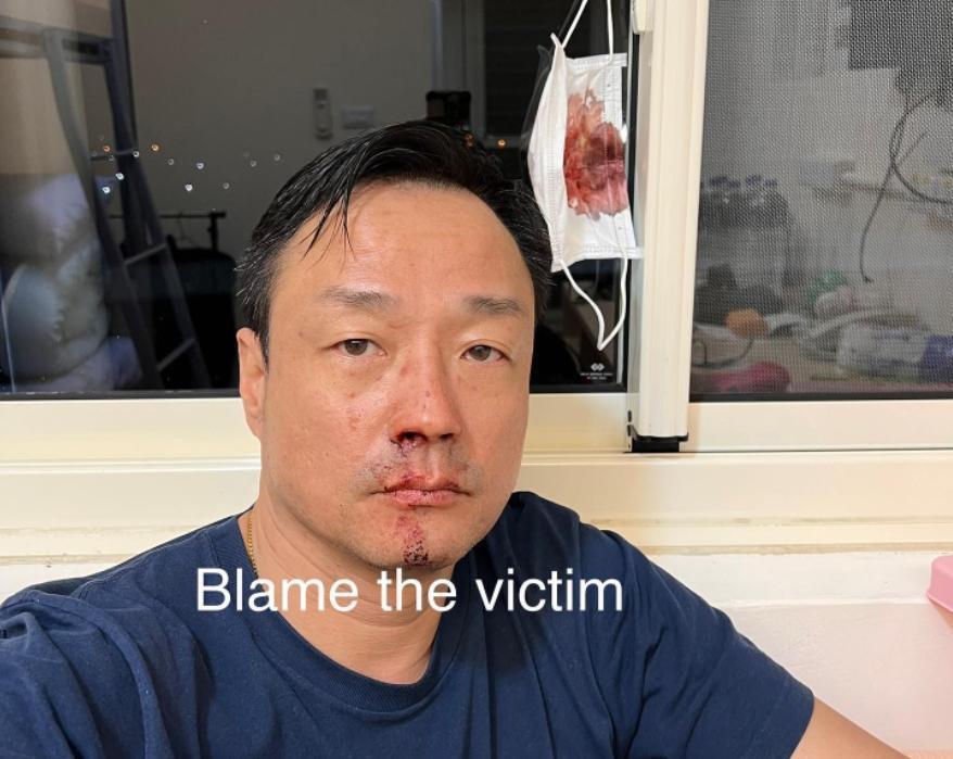 王喜被爆出在英國就確診,但卻能持PCR陰性報告入境台灣,引發質疑。(翻攝自王喜臉書)