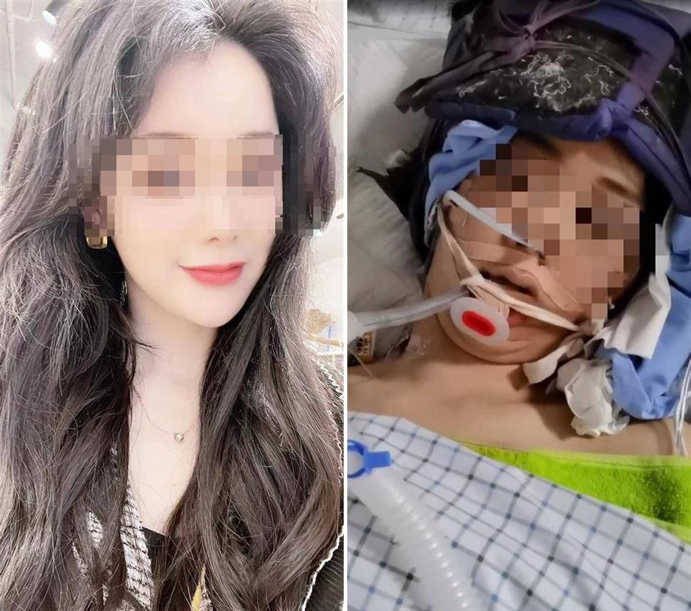 人妻被丈夫家暴打到心跳停止,搶救5天身亡,家屬非常後悔當初勸她別離婚。(翻攝《極目新聞》)