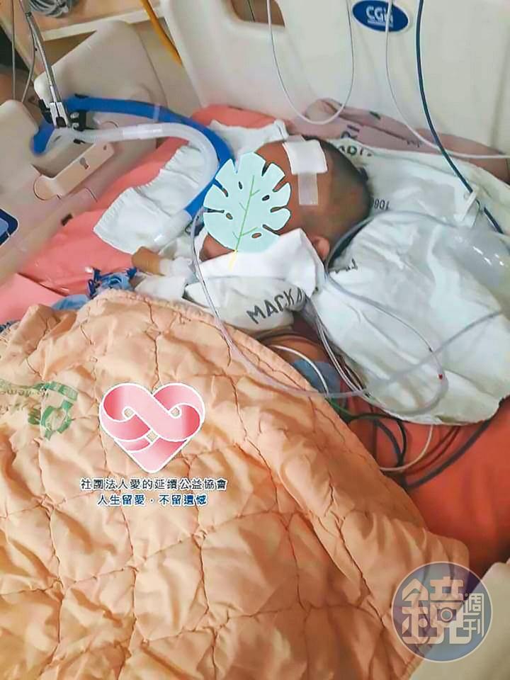 去年初，許姓少年3度病發進行手術，但術後復原狀況不佳。（讀者提供）