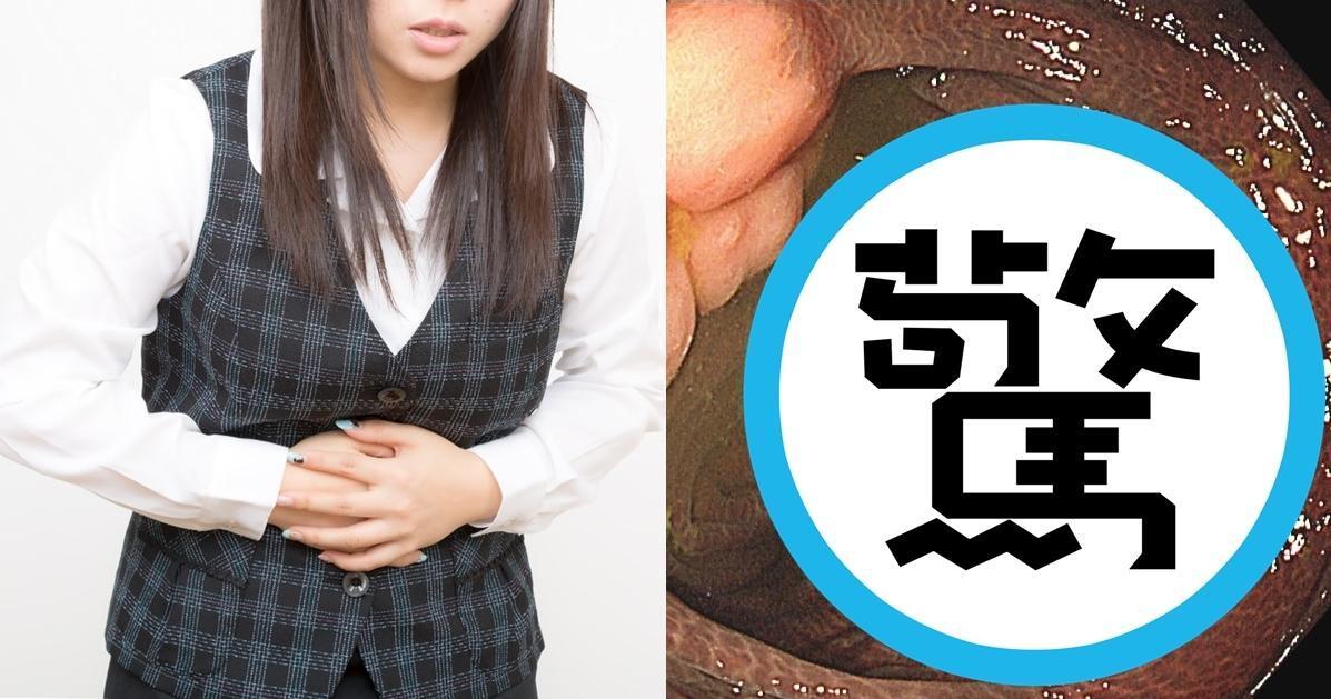 一位女子因為長期受便祕所苦,必需靠瀉藥才能順利排便。(示意圖,Pakutaso;翻攝詹宜學醫師臉書)