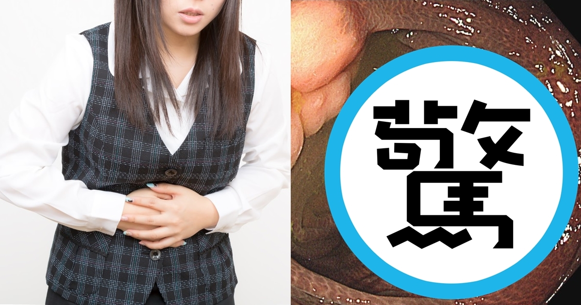 一位女子因為長期受便祕所苦,必需靠瀉藥才能順利排便。(示意圖,Pakutaso;翻攝詹宜學醫師臉書)