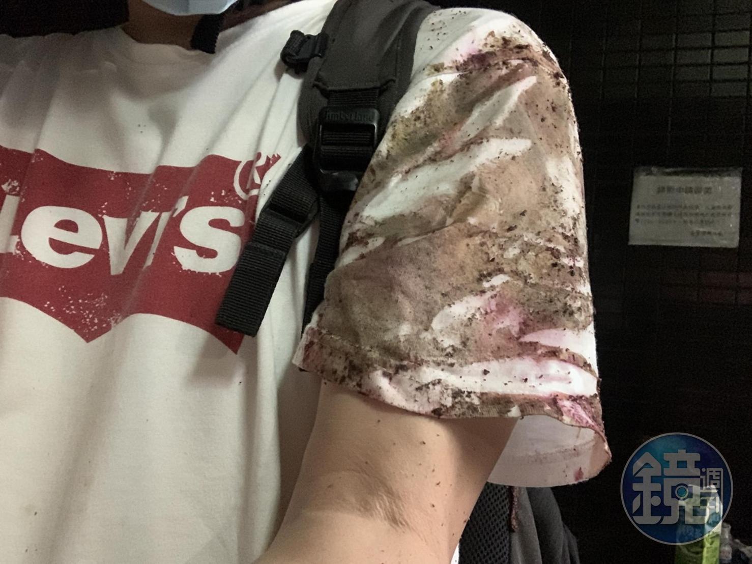 被害騎士路過一片爛泥摔車後,全身泥濘,白色T-Shirt變得髒兮兮。(讀者提供)