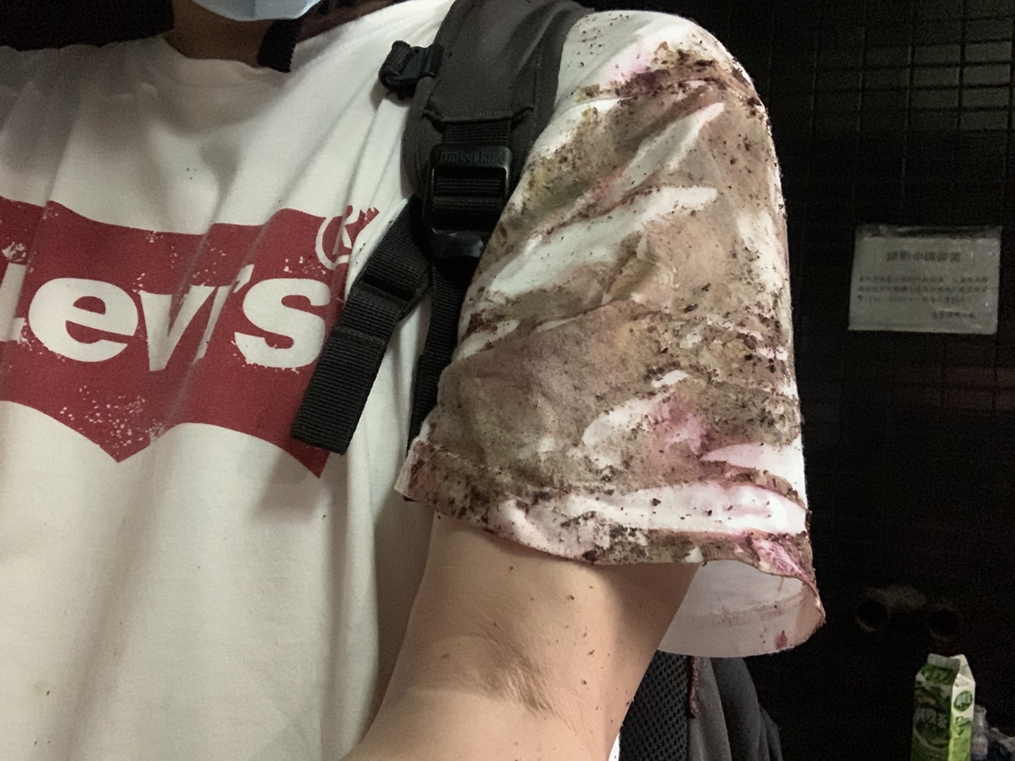 被害騎士路過一片爛泥摔車後，全身泥濘，白色T-Shirt變得髒兮兮。（讀者提供）