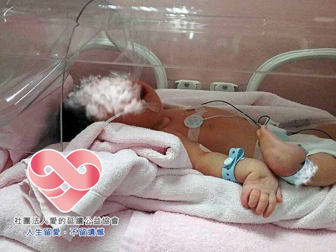 男童小節（化名），一出生就四肢嚴重變形、重症纏身，無法自主呼吸。（翻攝社團法人愛的延續公益協會臉書）