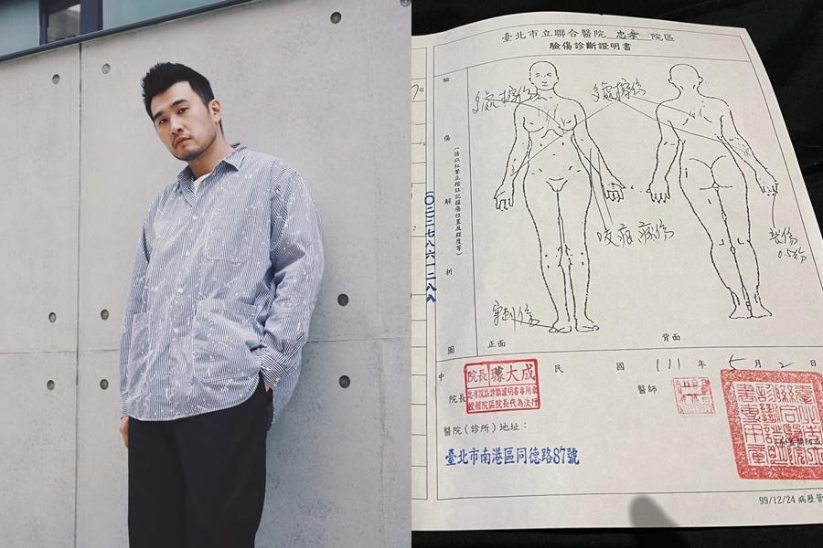 男星林曜晟昨日被爆對女性友人施暴，今他則亮出驗傷單稱「絕對沒有主動暴力毆打」。（翻攝自林曜晟臉書）