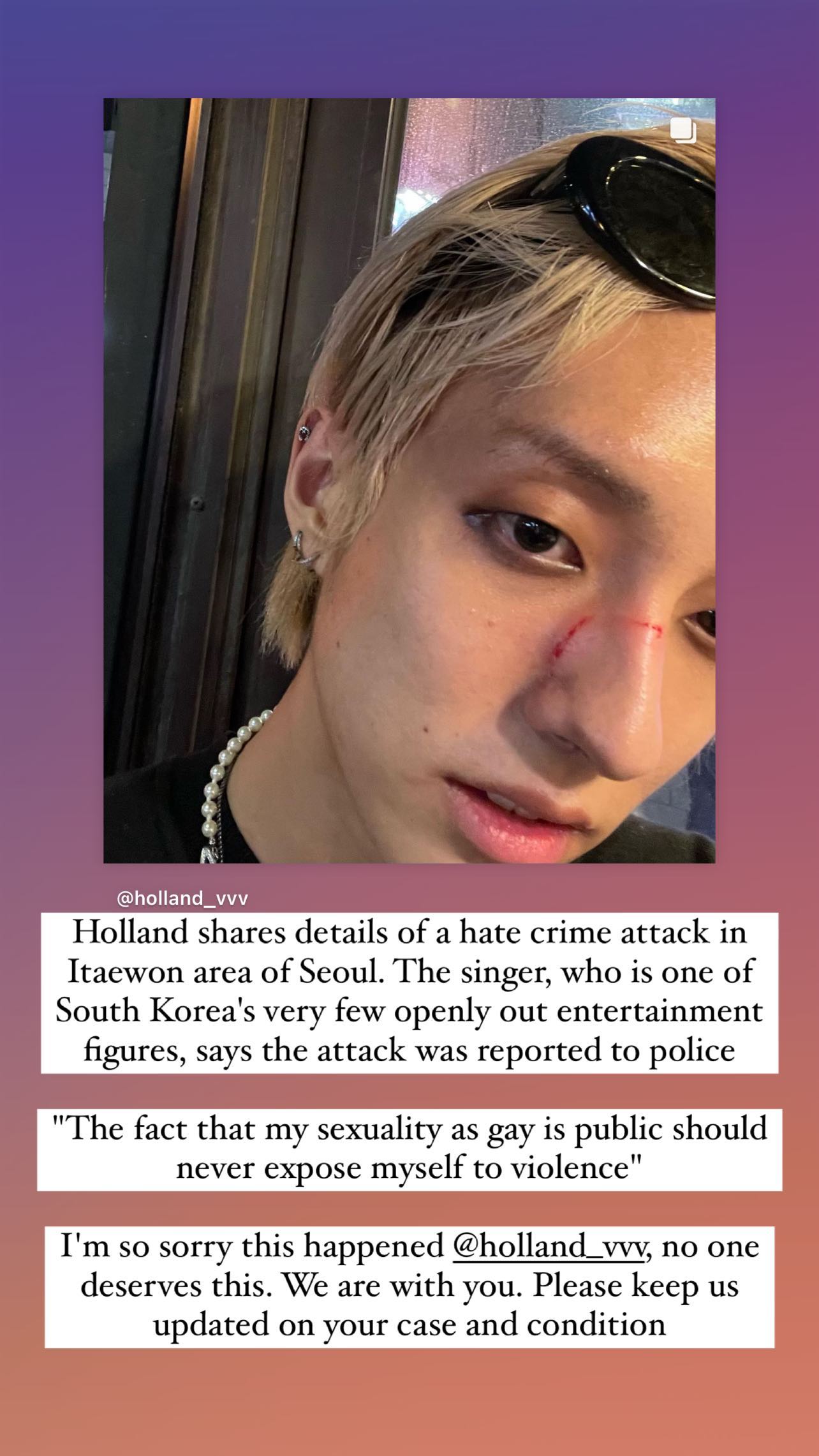 美國Billboard資深編輯Jeff Benjamin轉發了Holland被打的貼文，譴責暴力。（翻攝Jeff Benjamin IG)