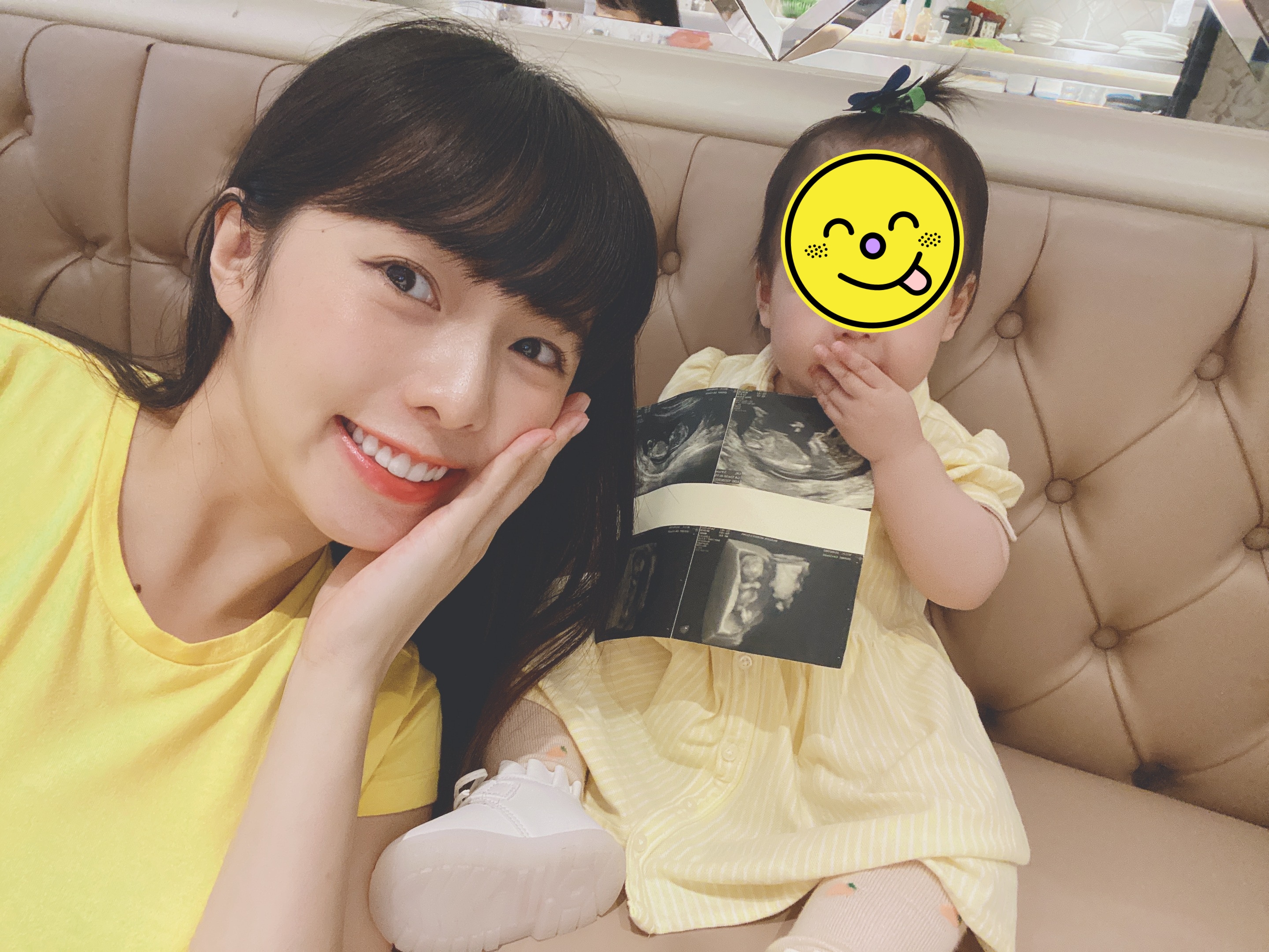 簡廷芮懷了第二胎，開心和超音波合照。（藝和創藝提供）