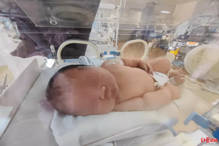 中國一名婦女在孕期體重疏於管理，導致生下達5.98公斤的「巨嬰」。（翻攝自《紅星新聞》）