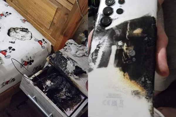 一名英國女子聲稱，三星手機在未充電情況下自燃，導致她因二度灼傷前往醫院治療。（翻攝自臉書）