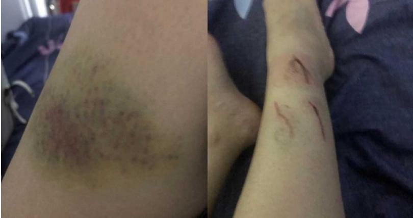 一名女子在臉書「爆廢公社」社團控訴，被介紹到柬埔寨工作，慘遭壓榨、虐待、被轉賣欠下更多債，甚至淪器官買賣的悲慘命運。（翻攝自臉書社團爆廢公社）