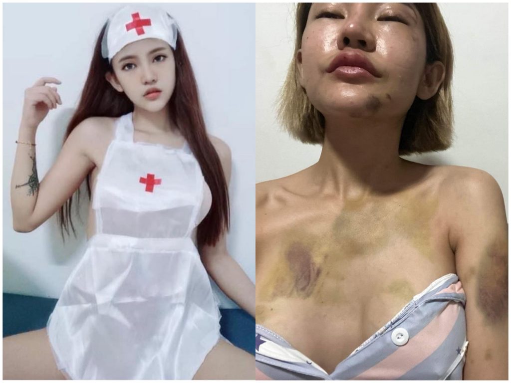 性感網紅遭男友家爆。（翻攝自娃娃臉書）